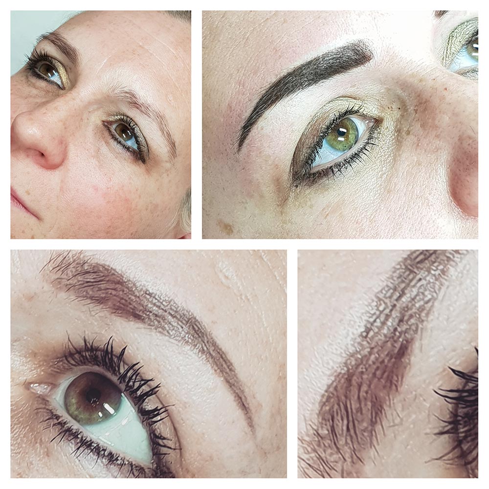 Eyebrow enhancement