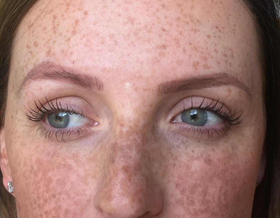 Microblading regrets, microblading results before we performed permanent makeup removal