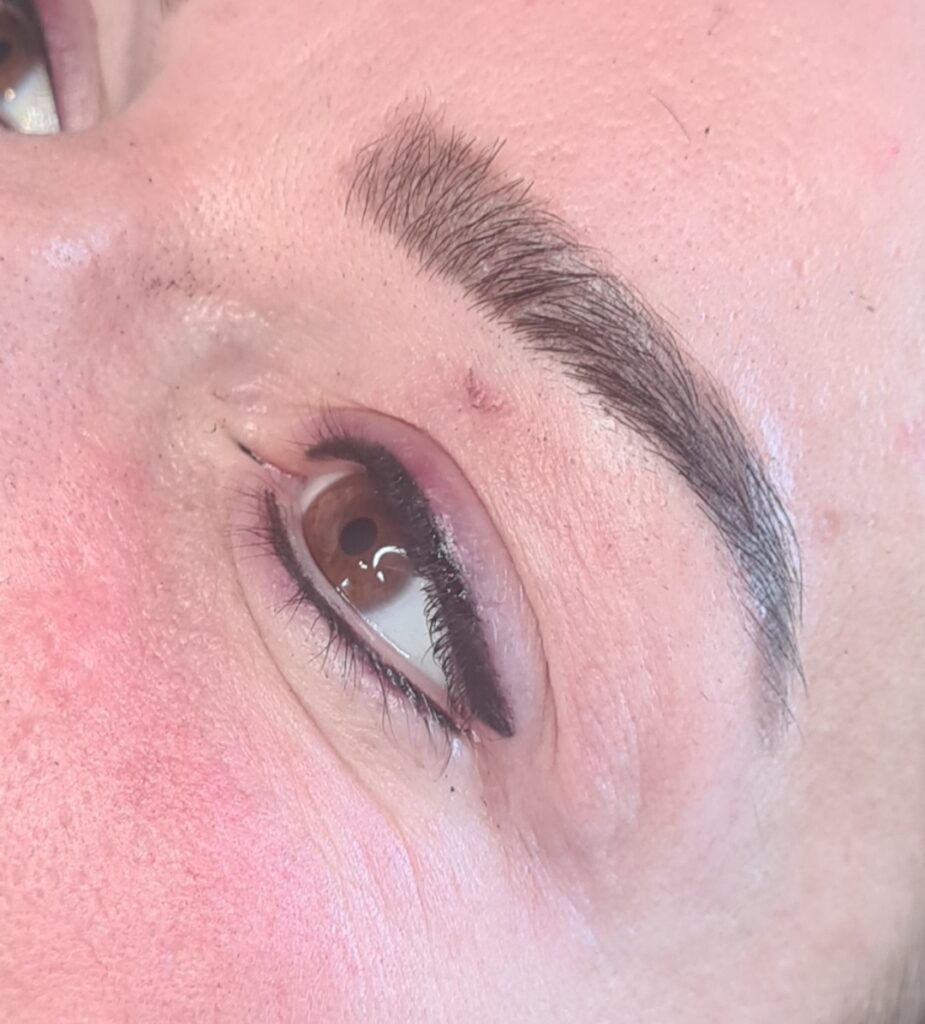 Eyebrow and eyeliner tattooing